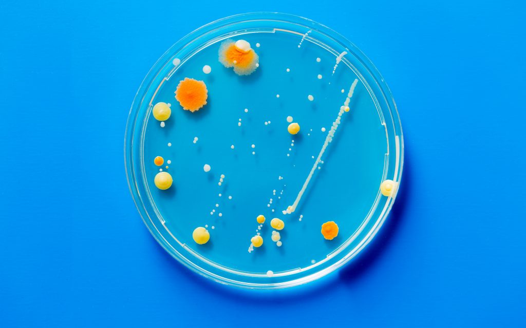 Petri dish with microbe colony