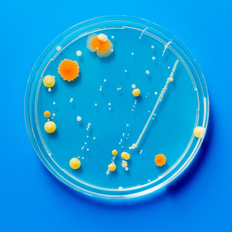 Petri dish with microbe colony